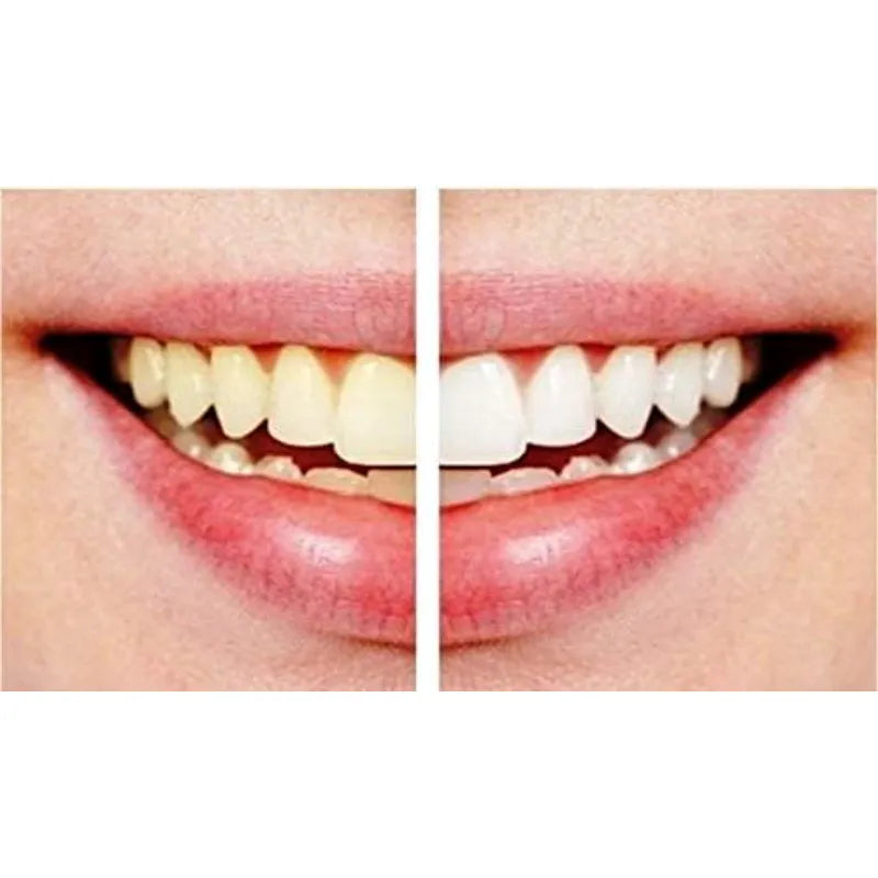 Pack of 2 Dazzling White Hygienic Professional Strength Teeth Whitening Pens