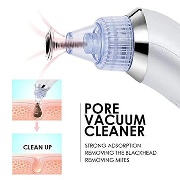 DermaSuction Vacuum Pore Cleaning Device with 4 Interchangeable Suction Heads and Electric Blackhead Remover for Clear Skin and Facial Rejuvenation