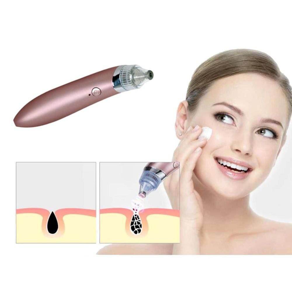 Face Pore Cleaner Blackhead Remover Vacuum Facial Cleaning Beauty Machine - Al-Raheem Imports