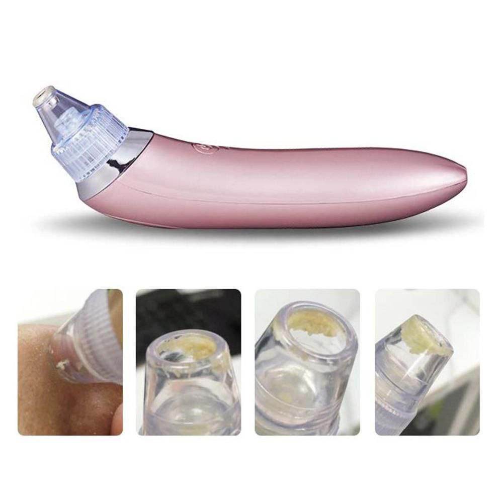 Face Pore Cleaner Blackhead Remover Vacuum Facial Cleaning Beauty Machine - Al-Raheem Imports