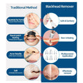 Multi-Functional Rechargeable 6 Suction Heads Blackhead Whitehead Extractor Remover Device Suction Tool - Al-Raheem Imports