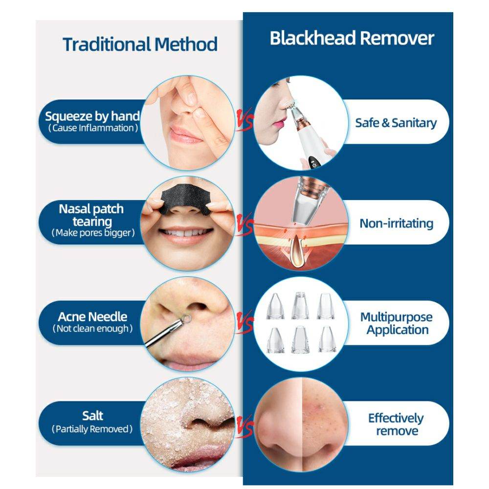 Multi-Functional Rechargeable 6 Suction Heads Blackhead Whitehead Extractor Remover Device Suction Tool - Al-Raheem Imports