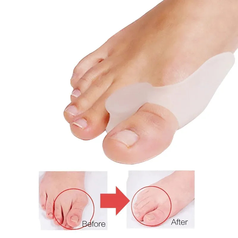 Silicone Gel Toe Separator Bunion Protector for Hallux Valgus Relief 1 Pair
