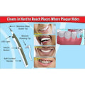 Sonic Dental Scaler Electric Polishing Teeth Whitening Tool with LED Light, Ultrasonic Plaque & Tartar Removal, Safe for Crowns and Implants - Al-Raheem Imports